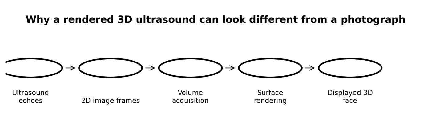 Educational pipeline diagram titled why a rendered 3D ultrasound can look different from a photograph, from ultrasound echoes through 2D frames, volume acquisition and surface rendering to a displayed 3D face. Educational illustration; not a diagnostic ultrasound image.