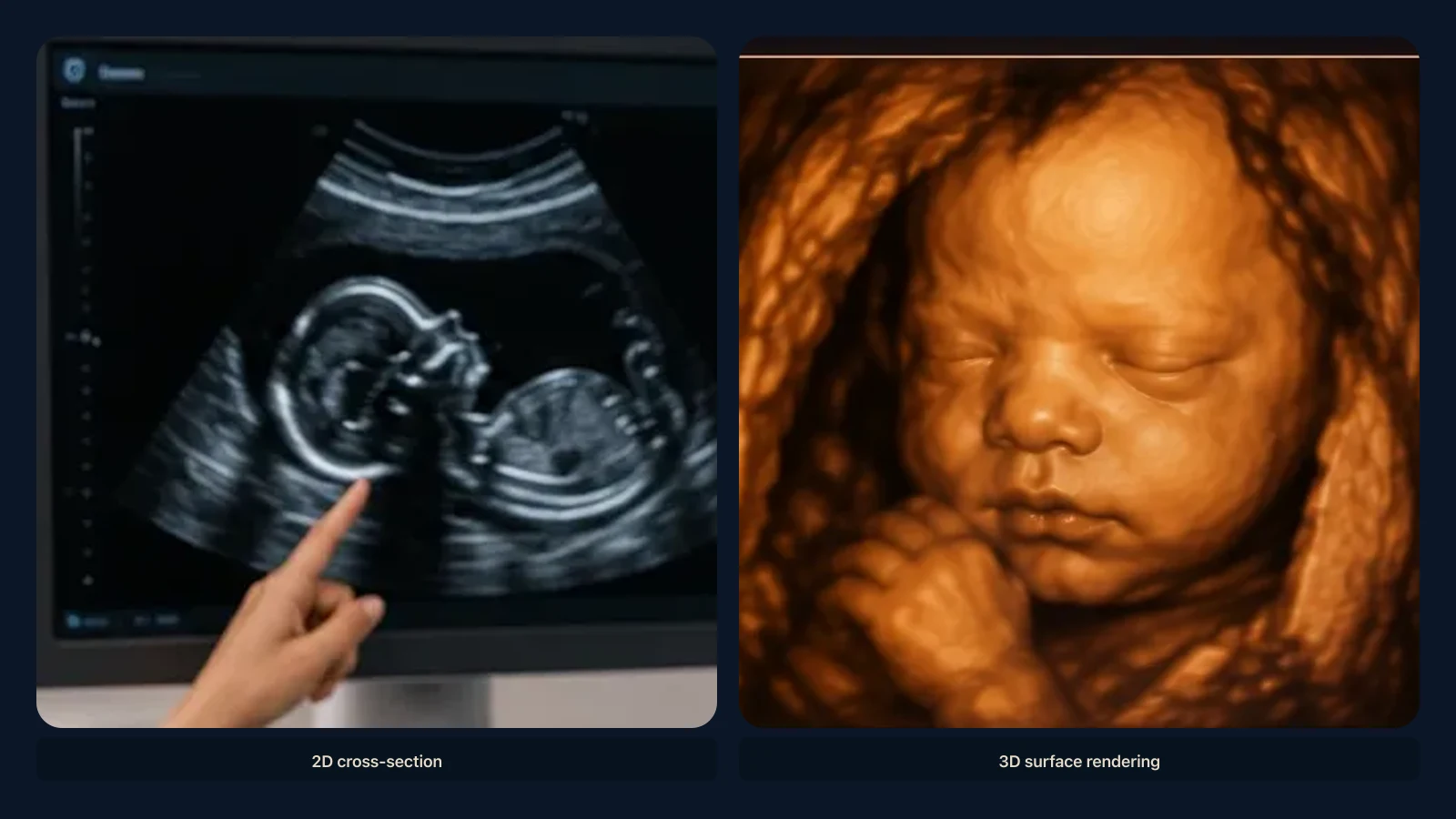 Educational visual for 2D vs 3D ultrasound. Educational illustration; not a diagnostic ultrasound image.