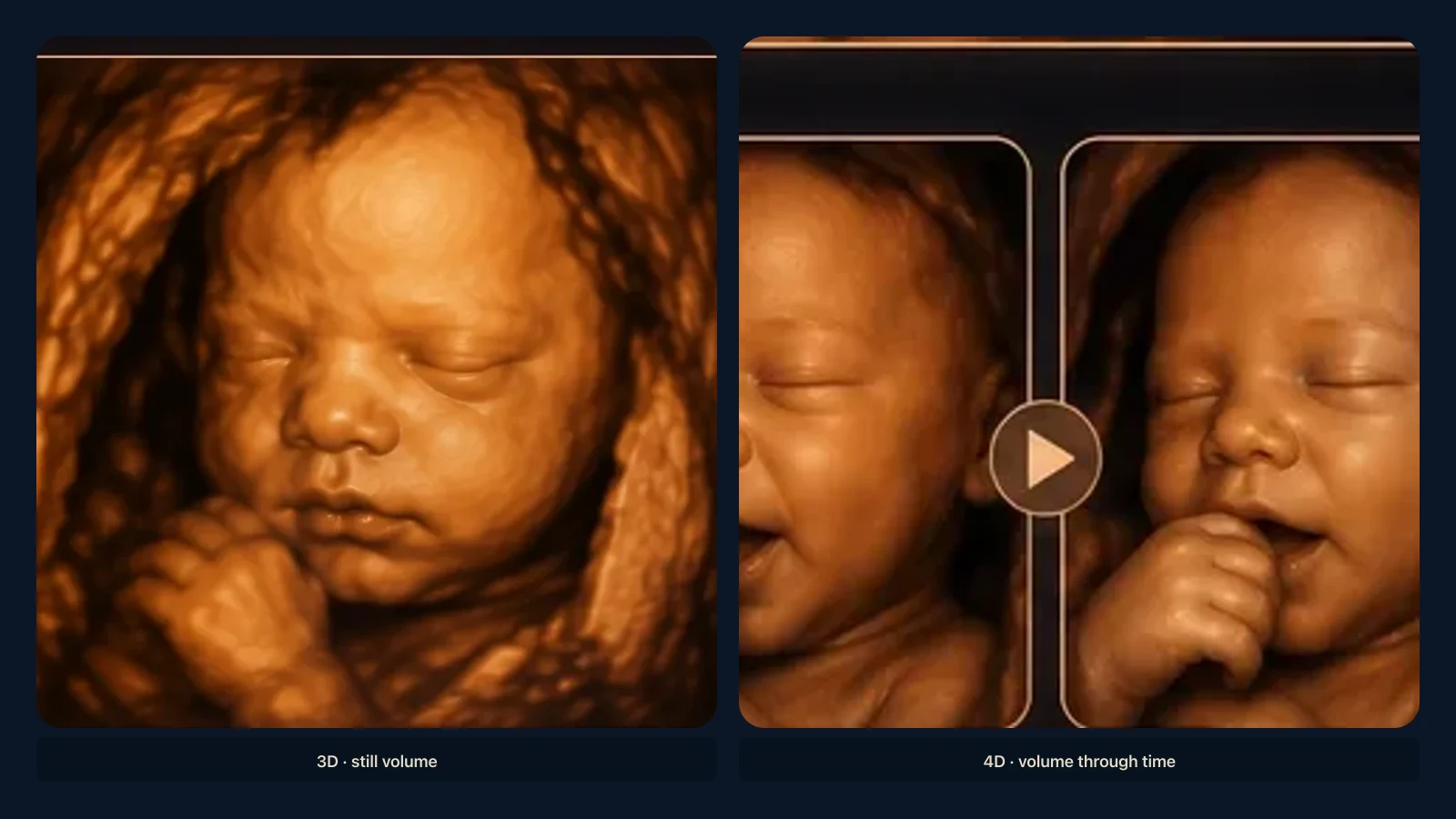 Educational visual of how 3D volume imaging and 4D motion relate. Educational illustration; not a diagnostic ultrasound image.