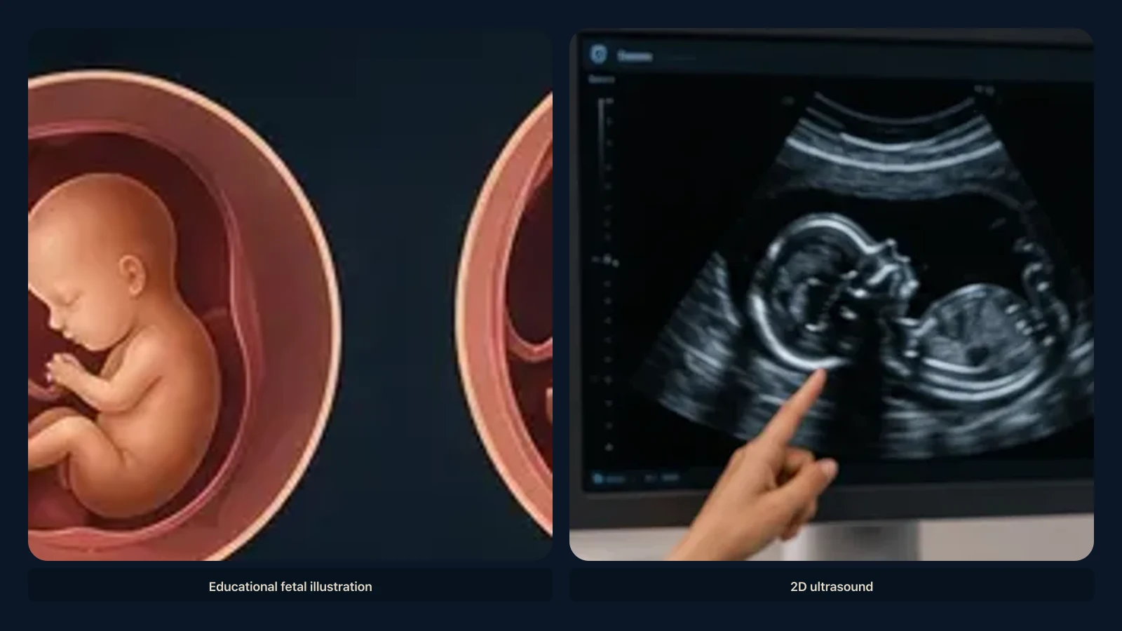 Educational visual for what a baby may look like at 24 weeks on ultrasound. Educational illustration; not a diagnostic ultrasound image.