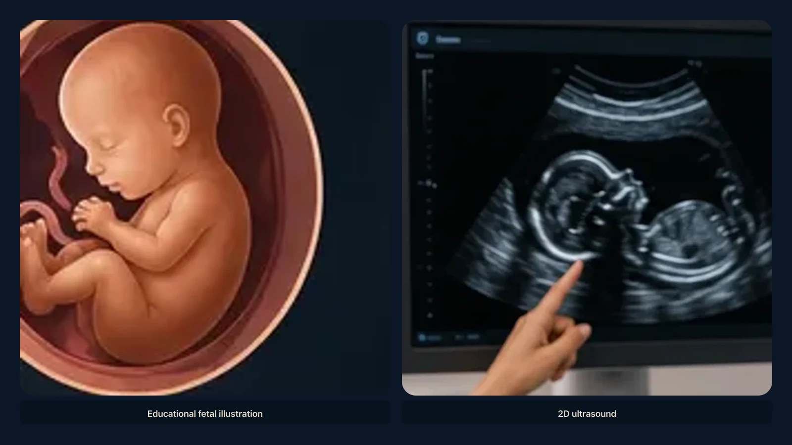 Educational visual for what a baby may look like at 28 weeks on ultrasound. Educational illustration; not a diagnostic ultrasound image.