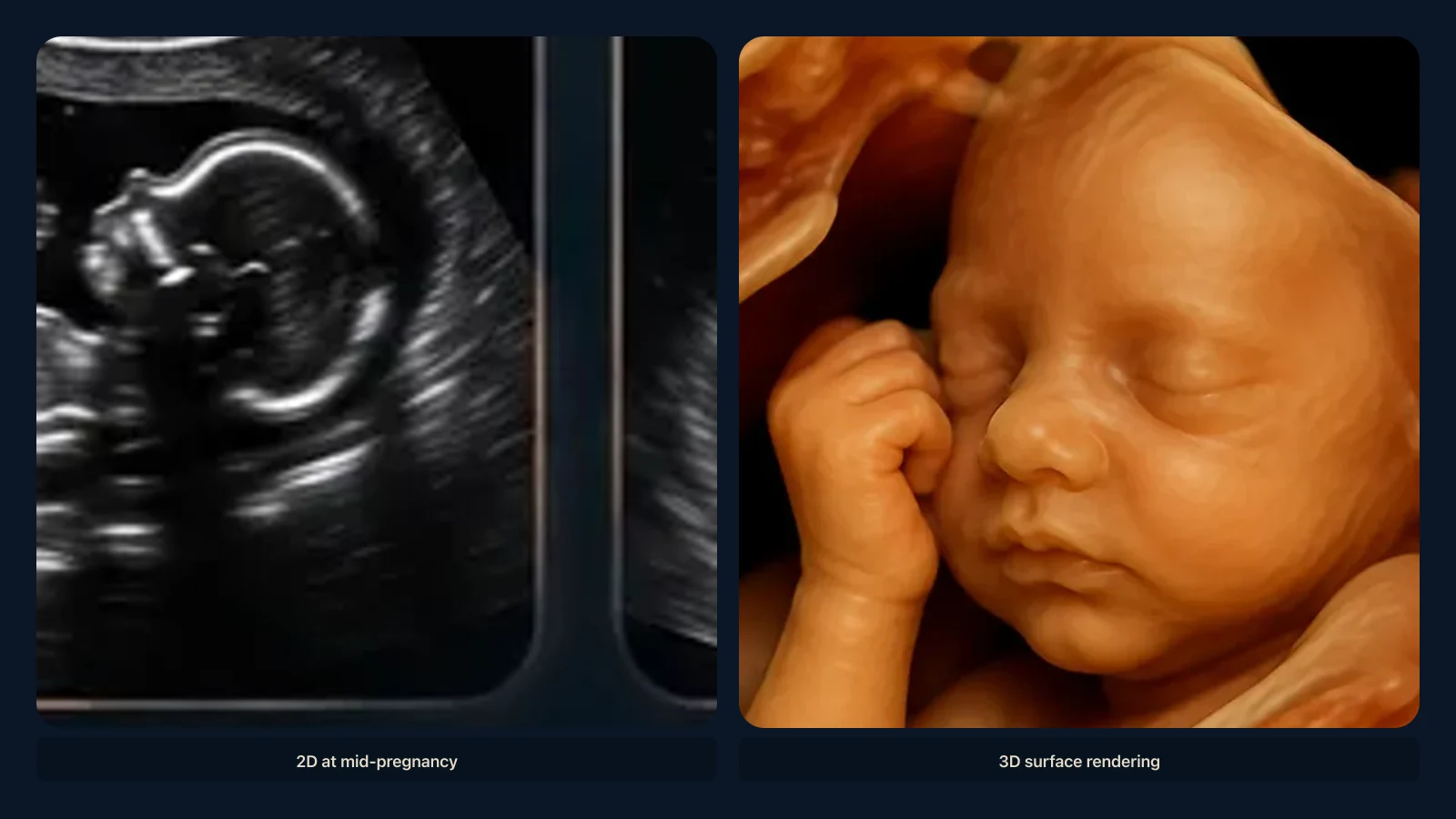 Educational visual for the best time for a 3D ultrasound. Educational illustration; not a diagnostic ultrasound image.