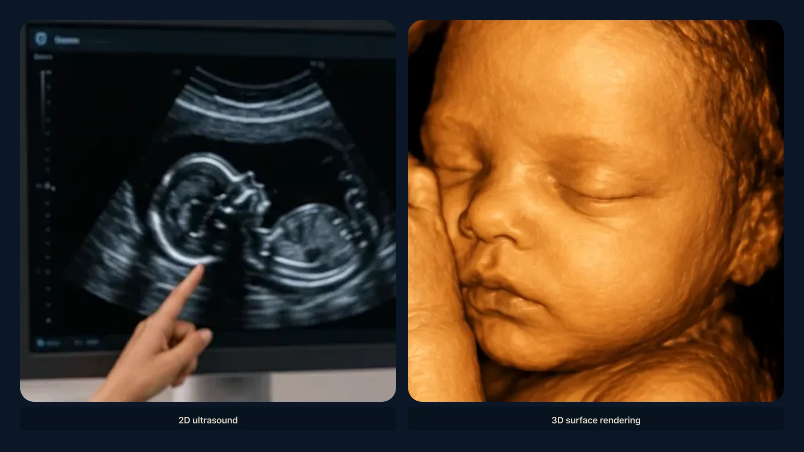 Educational visual for when you can see a baby’s face on ultrasound. Educational illustration; not a diagnostic ultrasound image.