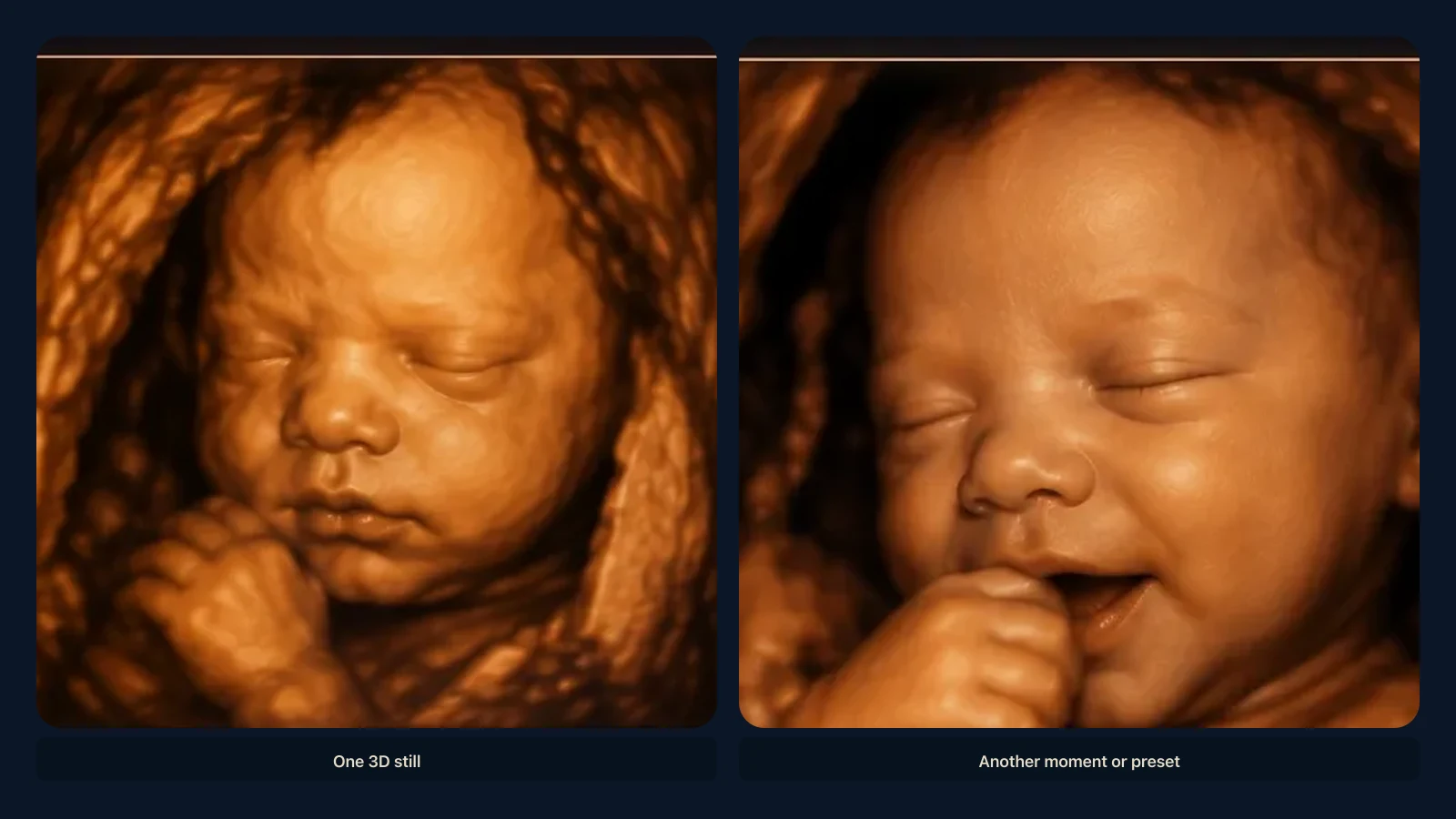 Educational visual for why a baby can look different on ultrasound. Educational illustration; not a diagnostic ultrasound image.