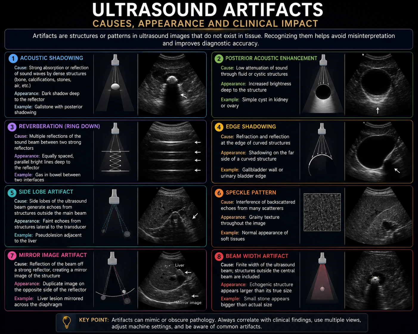 Common Ultrasound Artifacts