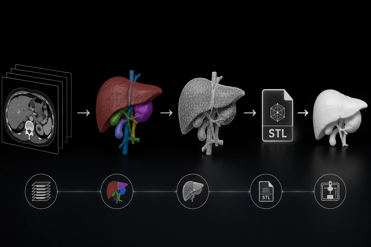 STL File Creation from Medical Imaging